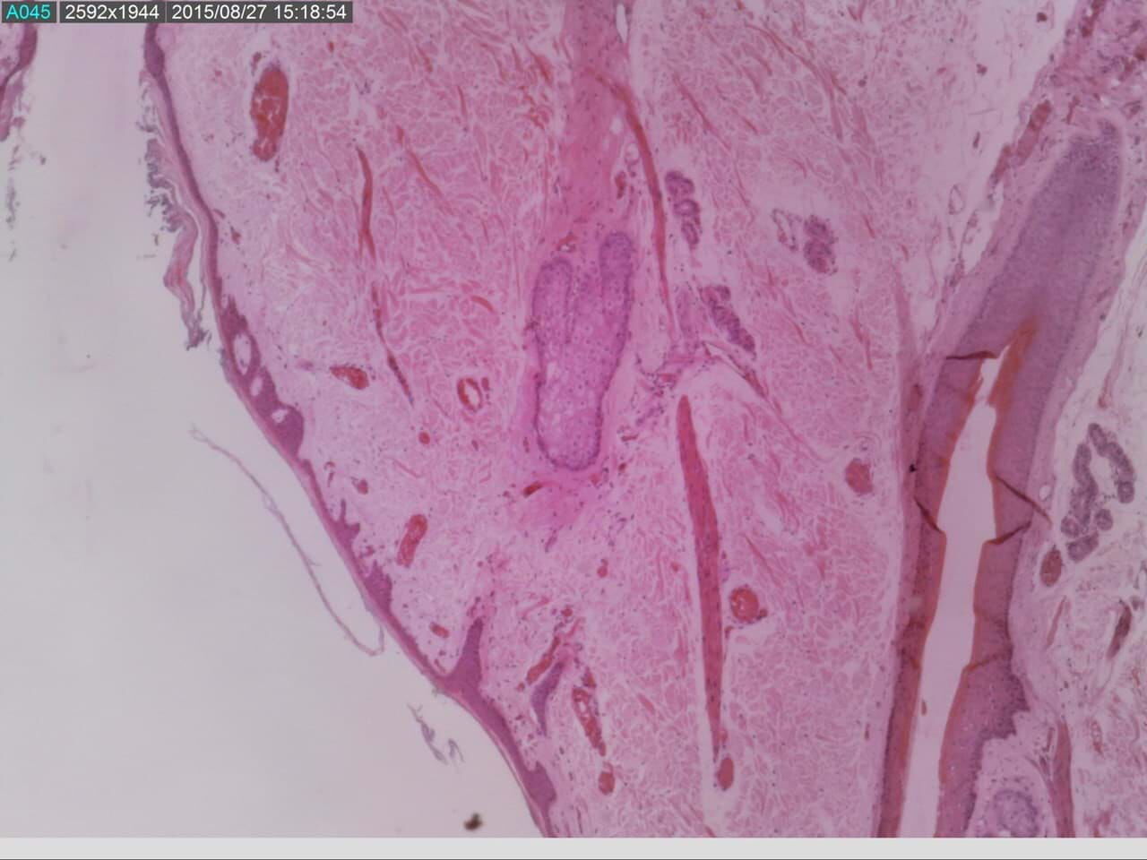 AM7515MZTL - Gewebewebe mit Follikel, feine Rosa- und Rottöne, mikroskopische Detailansicht