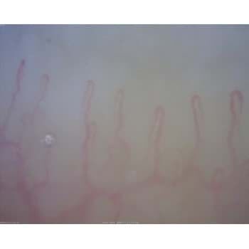 Nahaufnahme von Kapillaren. Rote Linien auf blau-gelbem Hintergrund.