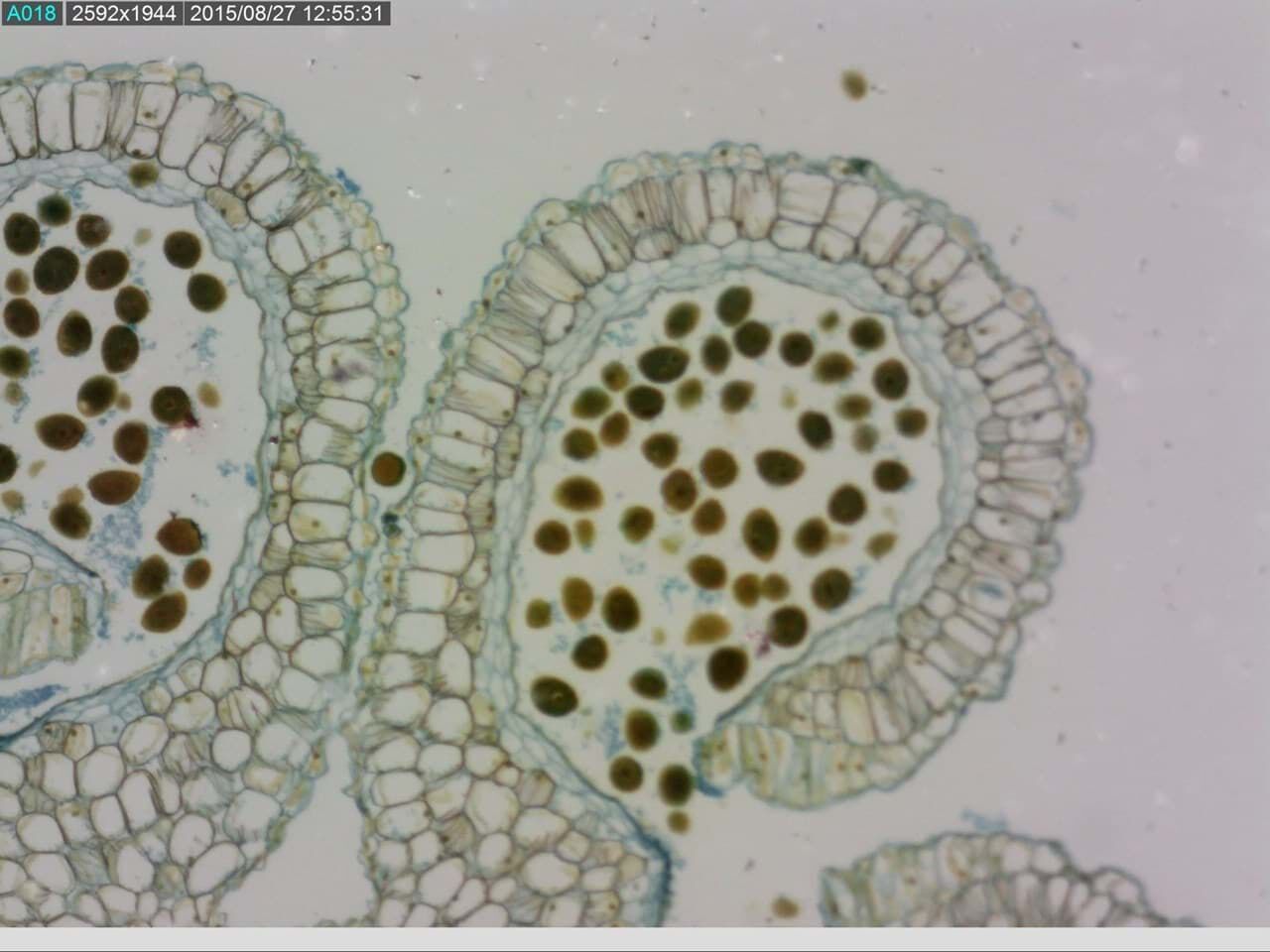 AM7115MZTL USB Mikroskop: Mikroaufnahme botanischer Sporen in Kapseln (Pollen) im Querschnitt